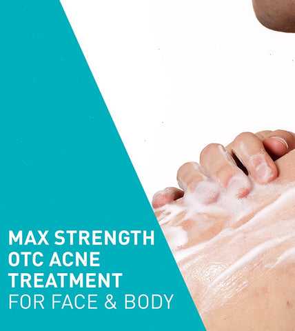 Acne Foaming Cream Wash