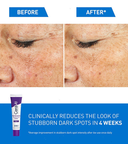 Skin Renewing Brightening Lotion with SPF 30